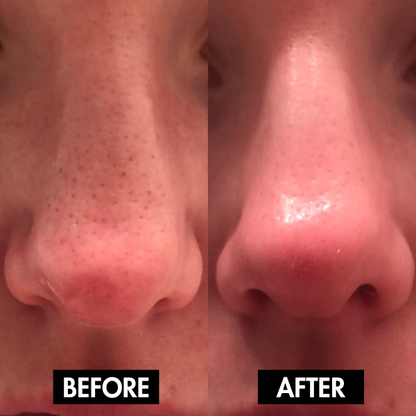 Lunoox™ Holy Basil Bubble Deep Mask