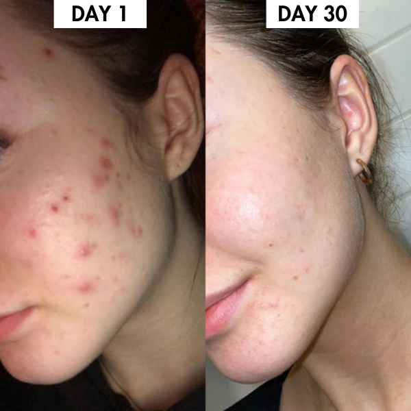 Lunoox™ Organic Silk Pillowcase (Buy 1 Get 1 Free)